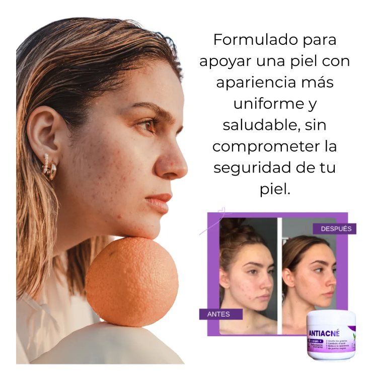 BB Cream Antiacné X3: Corrige, hidrata y protege tu piel